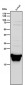 Anti-PSMB8 / LMP7 Monoclonal Antibody